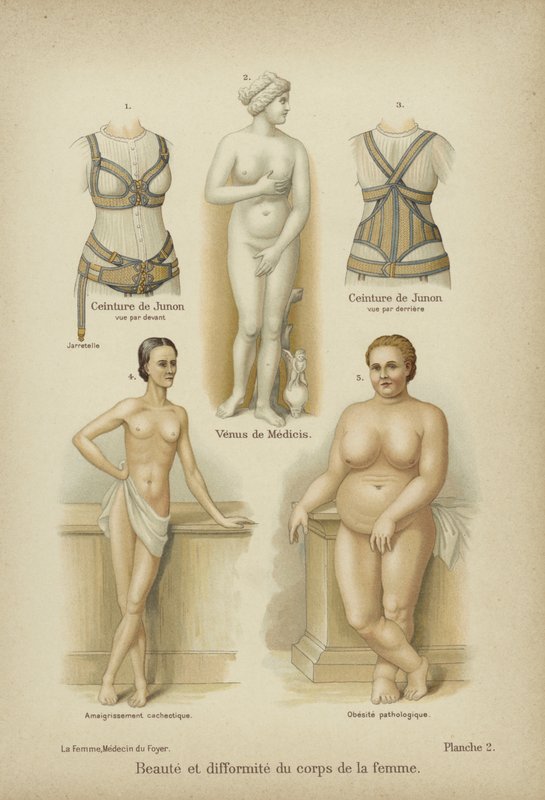 Beleza e misshapennes no corpo feminino de German School