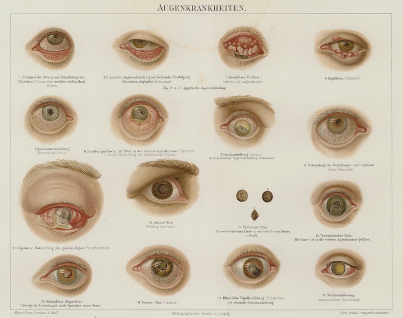 Distúrbios oculares (cor litho) de German School
