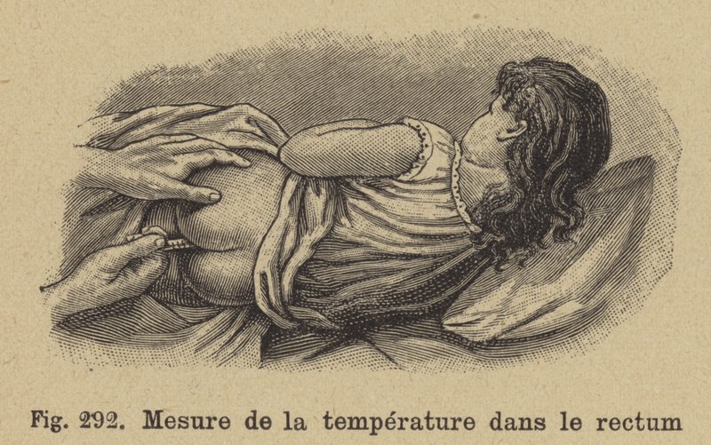 Tirando a temperatura da criança do reto de German School