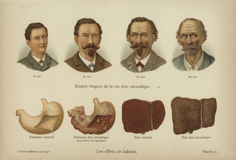 Os efeitos do abuso do álcool (cor litho) de German School