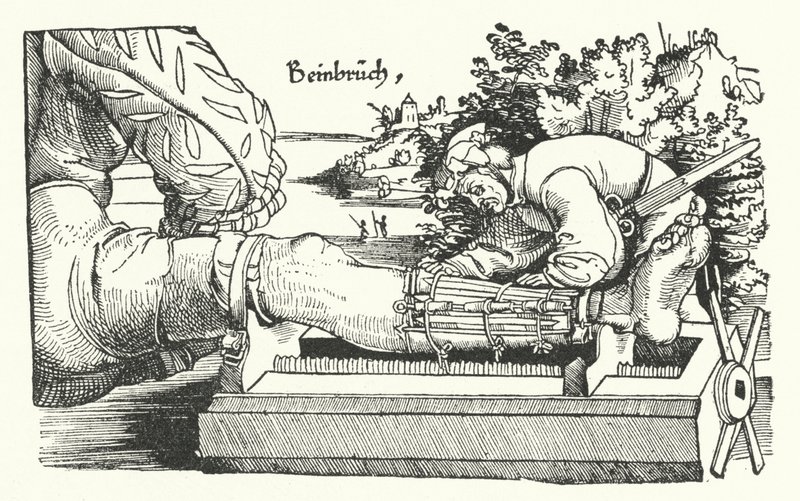 Tratamento de uma perna fracturada (gravação) de German School