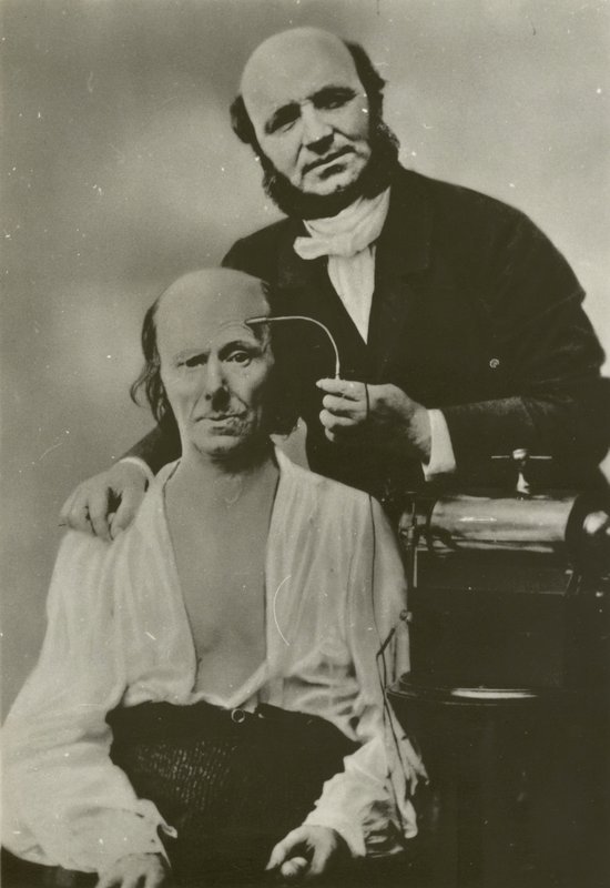 O neurologista francês Duchenne de Boulogne usando seu aparelho eletrofisiológico em um homem velho de Guillaume Benjamin Armand Duchenne de Boulogne