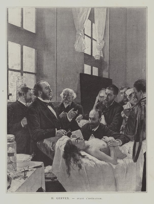 Avant lOperation (antes da operação) de Henri Gervex