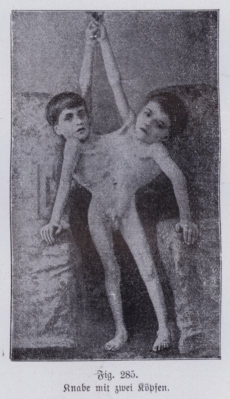 Giacomo e Giovanni Battista Tocci, gêmeos italianos juntos (foto a p/b) de Italian Photographer