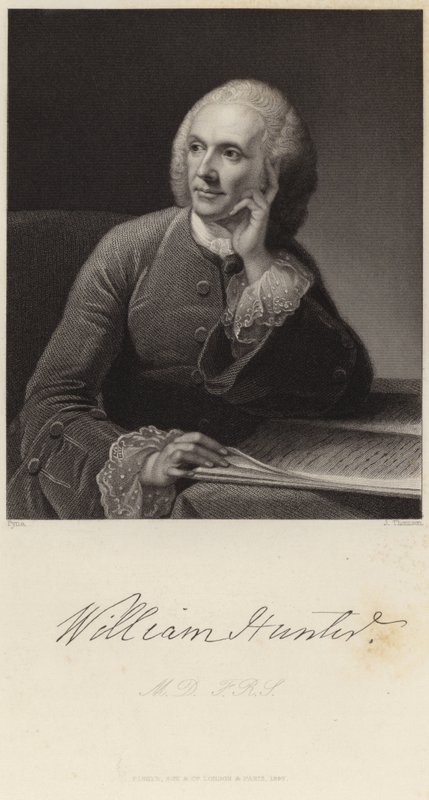 Retrato de William Hunter de James Baker Pyne
