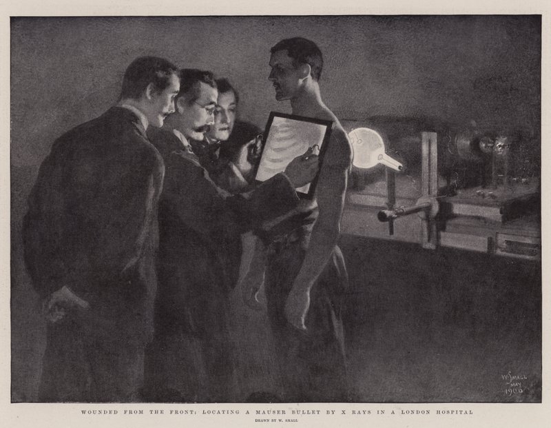 Ferido da frente, localizando uma bala Mauser por raios X em um hospital de Londres de William Small