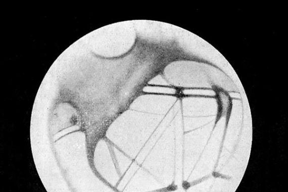 Giovanni (after) Schiaparelli