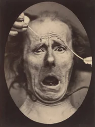 Electro-Fisiologia, Figura 64, 1854-56, impresso em 1862.