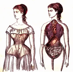 Espartilho de compressão - Vida normal e saúde por J. Rengade. Desenho de A. Demarle 1881