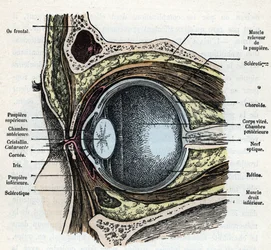 Corte vertical de um globo ocular com gravação de cataratas da colecção privada "Nature and Man" de Rengade 1881