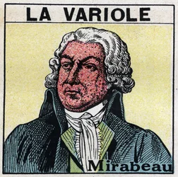 Retrato de Honore Gabriel (Honore-Gabriel) Riqueti, Conde de Mirabeau (1749-1791) com a face da figura por varíola. Para evitar cicatrizes causadas pela varíola, os pacientes devem ser tratados em quartos ou entrar apenas com luz vermelha, livre de raios u