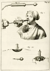Usando uma seringa para fornecer uma purga, a partir dos exercícios práticos para curar método por Frederic Dekkers, 1694