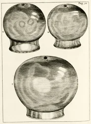 Vários ventosas, desde os exercícios práticos para curar método pelo Frederic Dekkers, 1694