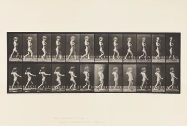 Placa 540.A, Pernas Curvas; Garoto; B, cárie espinhal; Menina andando, 1885