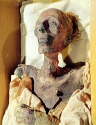 Corpo mumificado de Ramsés II (1304-1237 aC) encontrado em um túmulo em Deir al-Bahri