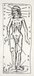 Um corpo que esteve sob o bisturi, com veias marcadas