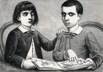 Crianças com estrabismo convergente e divergente ou olhos cruzados (gravura) 1888