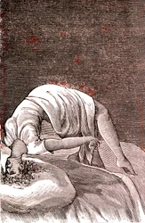 Histeria, perturbação mental e nervosa resultante de uma ansiedade intensa. 1887 (gravura)