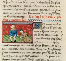 Ms 22532 Exame de um paciente com hemorróidas, de O Livro das Coisas das Coisas por Barthelemy English, c. 1410-1415