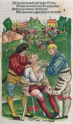 Removendo uma flecha, ilustração de Feldtbuch der Wundartzney por Hans von Gersdorff, 1540