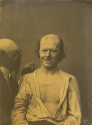 Um rosto descontraído (esquerda); falsa alegria ou riso (direita),1854-1856, impresso em 1862 (fotografia)