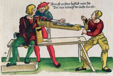 Aparelho para a cura de fraturas de braços, ilustração do "Feldtbuch der Wundartzney" de Hans von Gersdorff, c.1540 (xilogravura colorida)