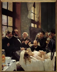 O Dr. Jules-Émile Péan (1830-1898) ensinando no Hôpital Saint-Louis a sua descoberta da pinçagem dos vasos. «Antes da operação». Pintura de Henri Gervex (1852-1929), 1887. A. 2,42 x 1,88 m, Paris, Musée d