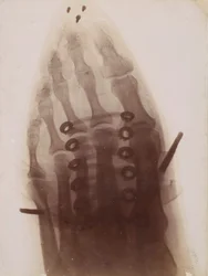 O pé no sapato, 1896.