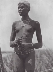 África: Rapariga Nuer com cicatrizes ornamentais (fotografia a preto e branco)