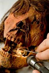 O Dr. John Varano, da Universidade de Tulane, examina os dentes da múmia.