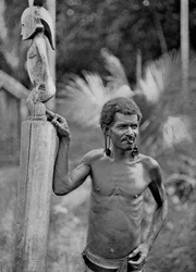 Malformação das orelhas, Ilhas Salomão, 1920.