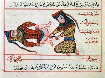 Medicina: operação de uma hermafodite. Miniatura de um Tratamento de Medicina Turca por Sharaf al-din