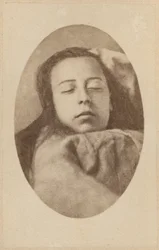 Ataque da histeria, segunda fase, ilustração da &39;Iconografia Fotográfica de La Salpetriere&39; de Bourneville et P. Regnard, placa III, Paris, 1876 (impressão albumen)