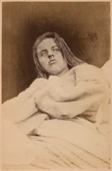 Epilepsia histérica, alucinações, desdém, estampa XXXI de «Iconografia fotográfica da Salpêtrière» de Bourneville e P. Regnard, Paris, 1876
