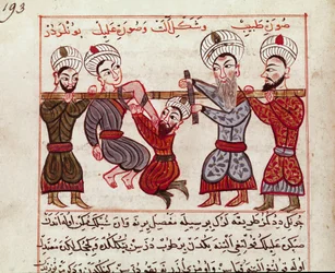 Medicina: intervenção ortopédica. Miniatura retirada de uma ordenha de medicina turca por Charaf-ed-din (Charaf ed Din) (1404-1468) após "La Surgery Imperiale" (Ms Sup Turk 693 fol. 193) 1466 Paris, B.N.