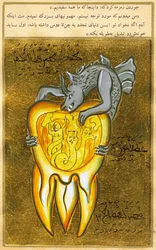 visão anatômica de um dente, a fonte da dor de dentes é mostrada como um demônio do inferno (aquarela e pó de ouro no papel)