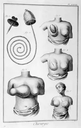 Cirurgia da mama, 1751-1777