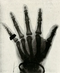 Radiografia da mão de HRH O Príncipe de Gales, c1897