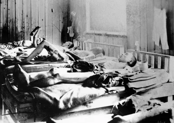 Sobreviventes da explosão da bomba atômica em Hiroshima, Japão, 1945