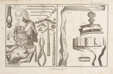 Trepanação