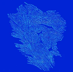 Secção transversal de tumores fibro-nucleados