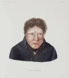 Doenças, Hanseníase Leproso Masculino, Islândia, início do século XIX