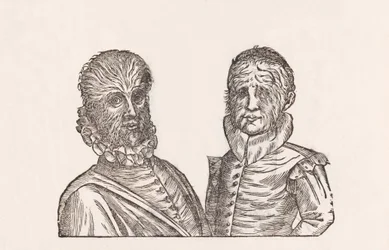 Pater annorum quadragina, & filus annorum viginti toto corpore pilosi