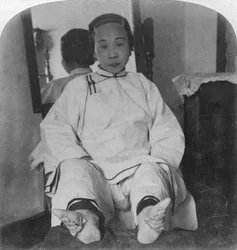 Uma casta alta ladys delicados pés de lírio, mostrando o método de deformidade, China, 1900.