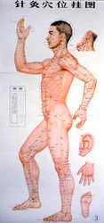 Acupunctura