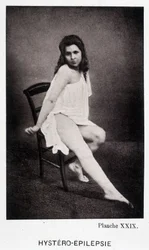 Hystero Epilepsie - Contractura em "Iconografia fotográfica da Salpétrière: serviço de Mr. Charcot" de Paul Regnard e Bourneville