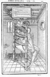 Corte no crânio. Quadro anatómico de "De dissectione partium corporis humani lbri tres..." Carlo Stefano Riverio, Paris 1545