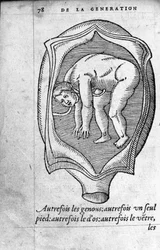 A posição do feto no útero durante a gravidez. Gravura da "De la generation des enfants" do médico e cirurgião francês Ambroise Pare (1509-1590) Século XVI