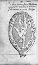 A posição do feto no útero durante a gravidez. Gravura da "De la generation des enfants" do médico e cirurgião francês Ambroise Pare (1509-1590) Século XVI