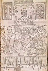 Autópsia. Códice. O corpo de um homem morto é dissecado por médicos para um estudo de anatomia. "Fascicula Medicinae". Códice do fascículo de um médico de Johannes Kethan.